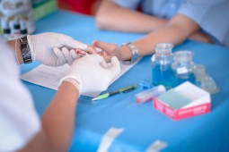 Ada 4 Tahapan HIV ke AIDS, Awalnya Tanpa Gejala