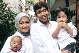 Anak Dede Sunandar Idap Williams Syndromes, Kenali Karakteristiknya