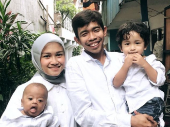 Anak Dede Sunandar Idap Williams Syndromes, Kenali Karakteristiknya