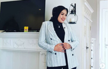 Risiko di Balik Kikir Gigi Seperti yang Dilakukan Ely Sugigi