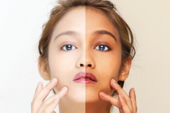 Benarkah Suntik Putih Bisa Sebabkan Kematian?