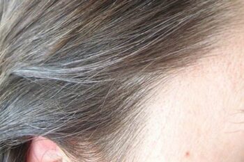Rambut Beruban di Usia Masih Muda? Ini Cara Pencegahannya