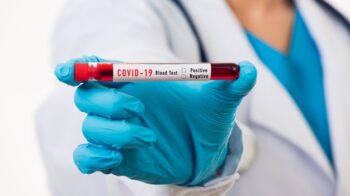 D-dimer Pasien Covid-19, Apa Maksudnya? Cek Faktanya