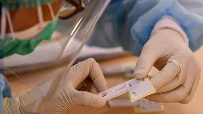 Bayi Berusia 29 Hari di Pamekasan Positif Covid-19, Tertular dari Keluarga