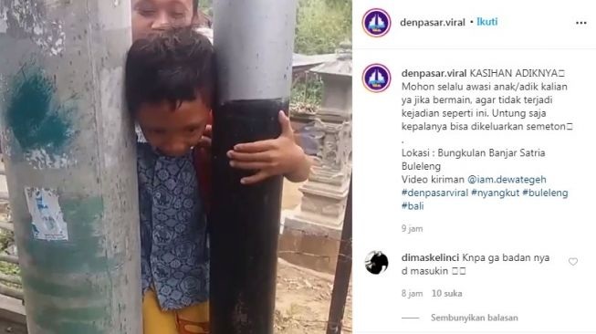 Waduh! Kepala Bocah di Bali Terjepit di Antara Tiang Listrik