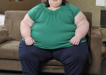 Inilah Penyebab Kelebihan Berat Badan Atau Obesitas   