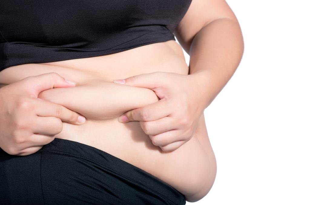 Obesitas dapat sebabkan Kanker (dokter sehat)