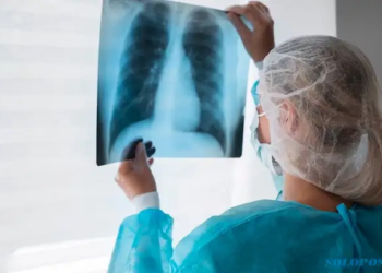 Kasus Mycoplasma Pneumoniae Ditemukan di Indonesia, Ini Antisipasi DKK Solo