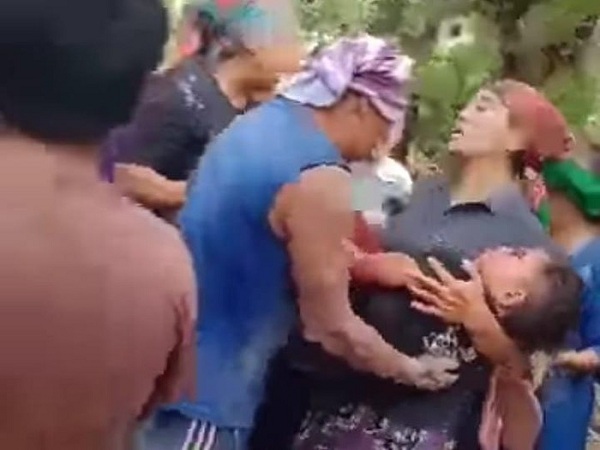 Blar! Tas Isi Bondet Meledak, Empat Anak di Pasuruan Terluka