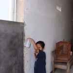 Terapi Kelereng Pasca Operasi Tangan Patah