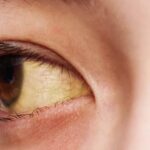 5 Kebiasaan Buruk Ini Bikin Mata Mudah Sakit, Lho!