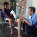 Cara Membeli Kaki Palsu Untuk Anda Yang Tinggal Di Daerah