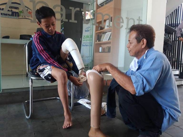 Cara Membeli Kaki Palsu Untuk Anda Yang Tinggal Di Daerah