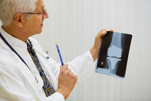 Biaya Operasi Total Knee Replacement Serta Informasi Lengkapnya