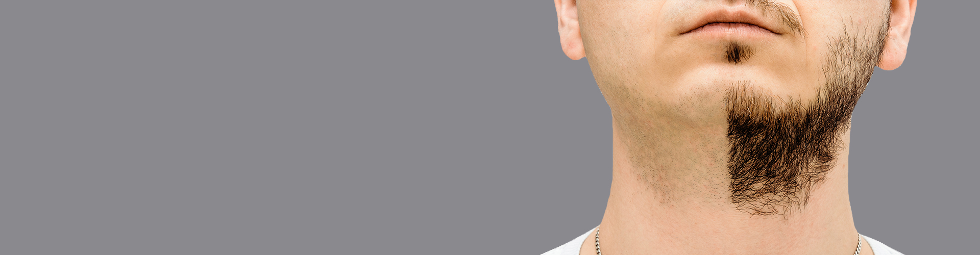 beard-and-moustache-transplant-banner