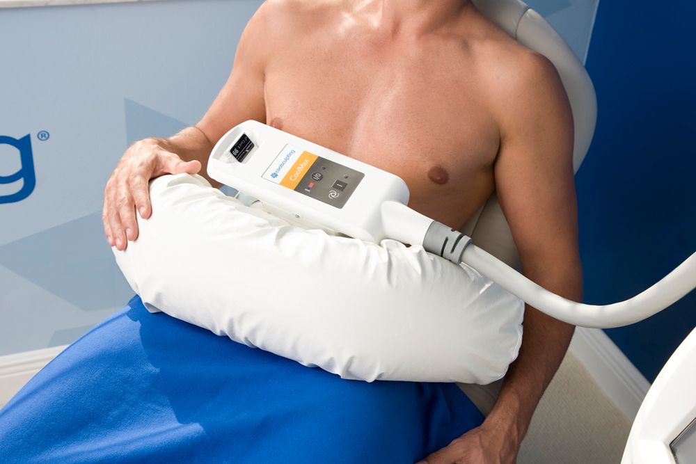 Coolsculpting